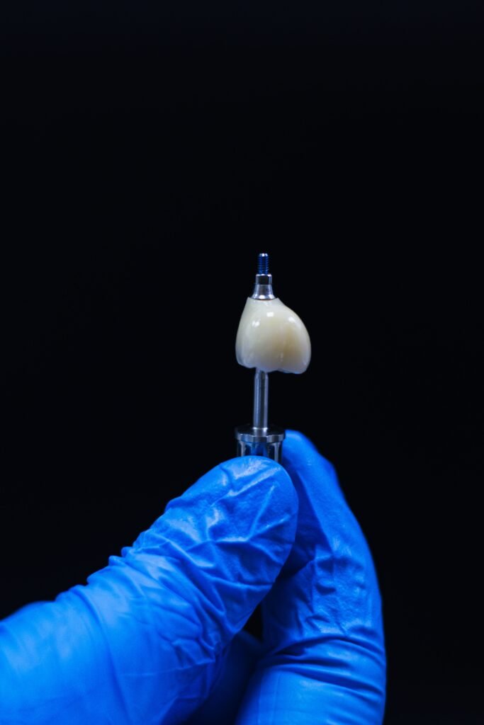 Implant dentar Bistrița - Utopia Dental